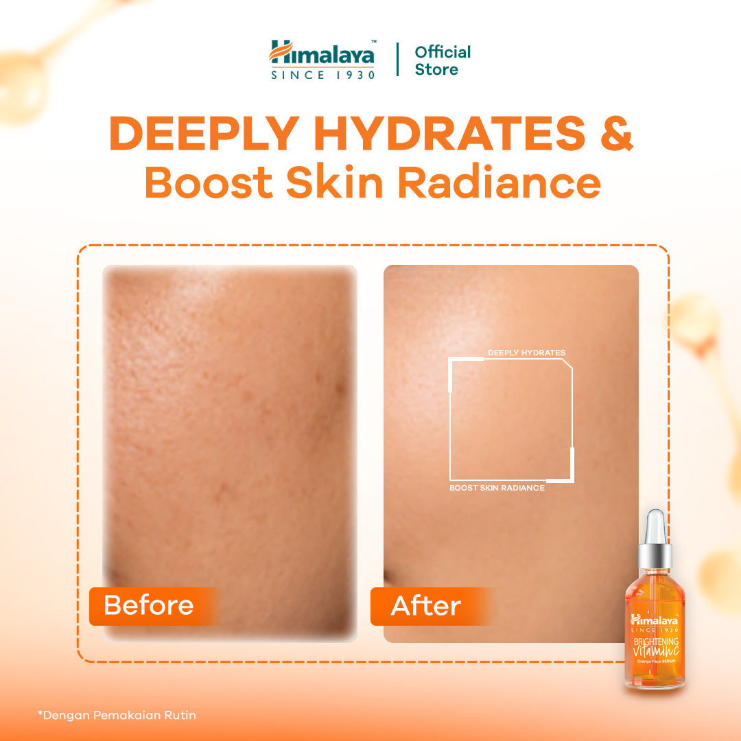 Himalaya Brightening Vitamin C Orange Face Serum