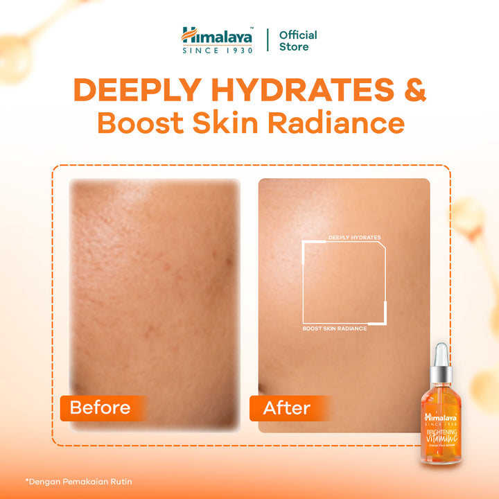 Himalaya Brightening Vitamin C Orange Face Serum