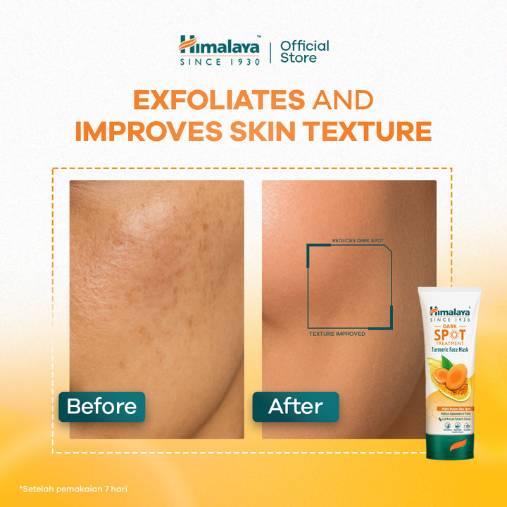 Himalaya Dark Spot Treatment Turmeric Face Mask