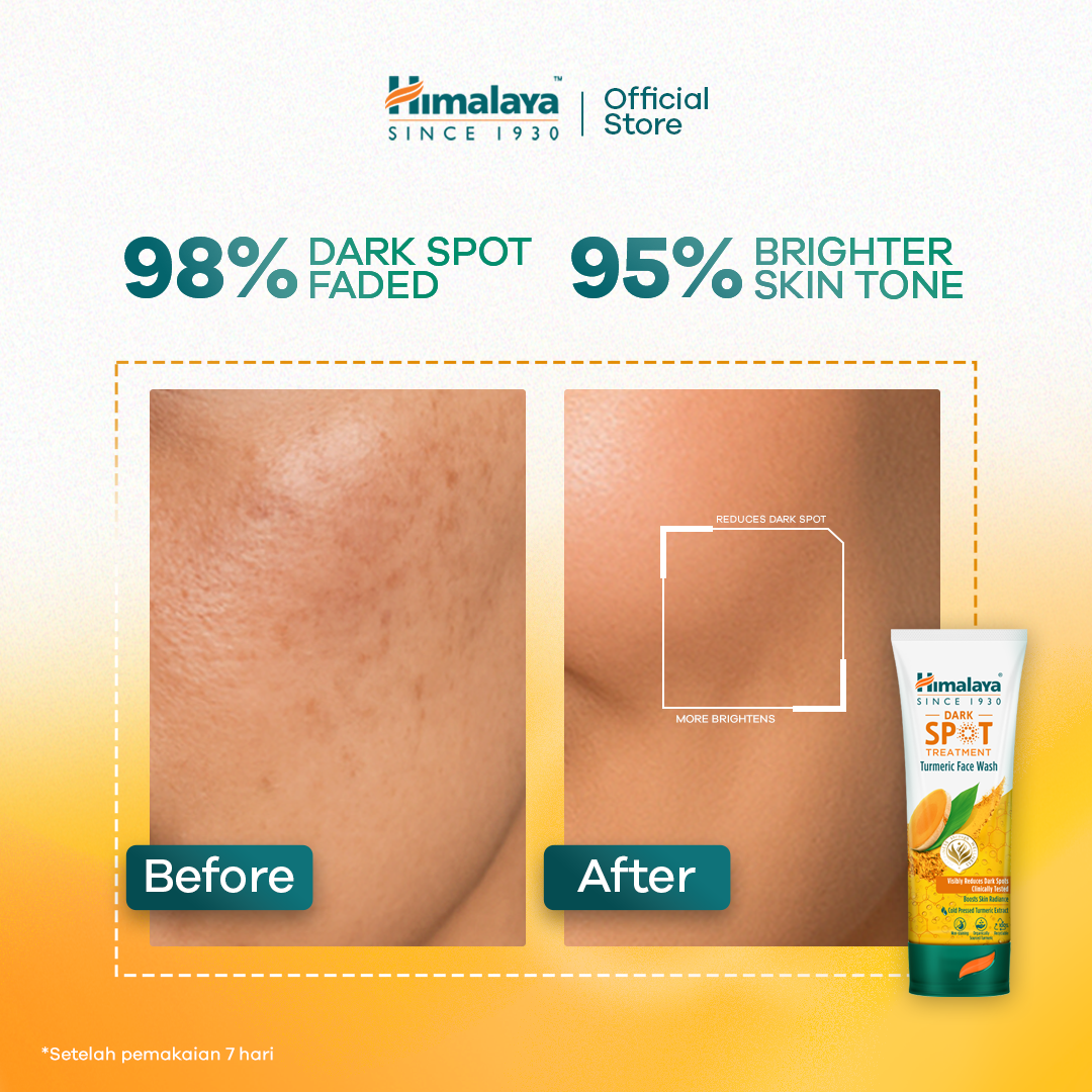 Himalaya Dark Spot Treatment Turmeric Face Wash