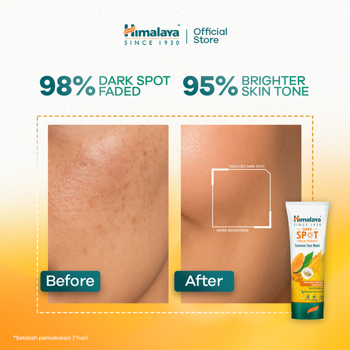 Himalaya Dark Spot Treatment Turmeric Face Wash