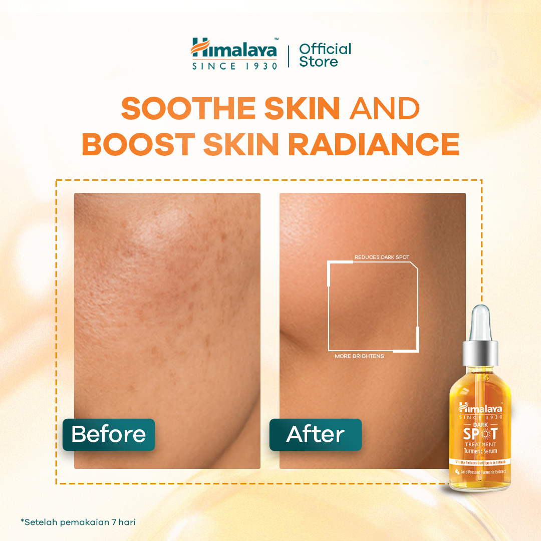 Himalaya Dark Spot Treatment Turmeric Face Serum