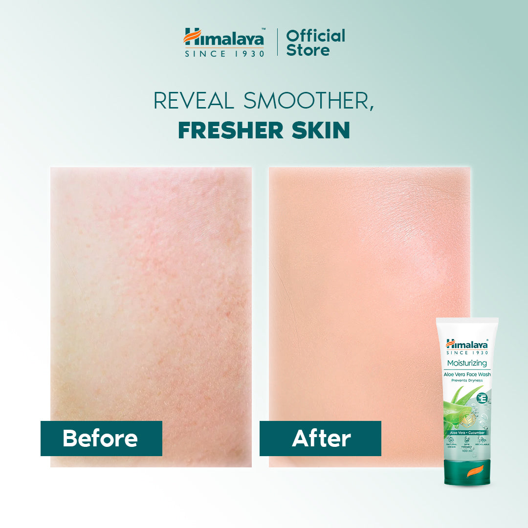 Himalaya Moisturizing Aloe Vera Face Wash