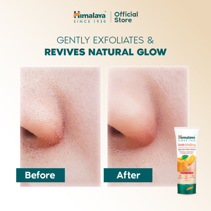 Himalaya Gentle Exfoliating Daily Face Wash