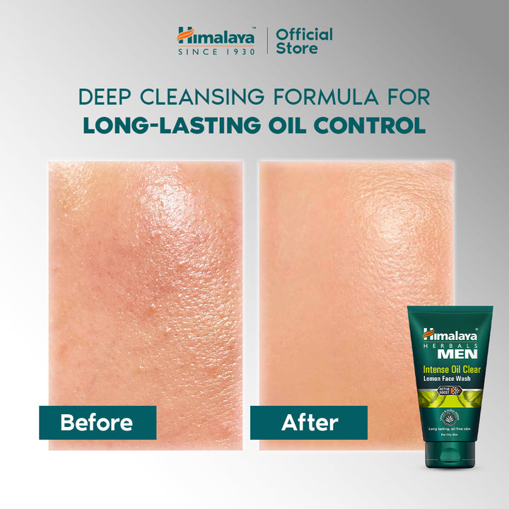 Himalaya Men Intense Oil Clear Lemon Face Wash