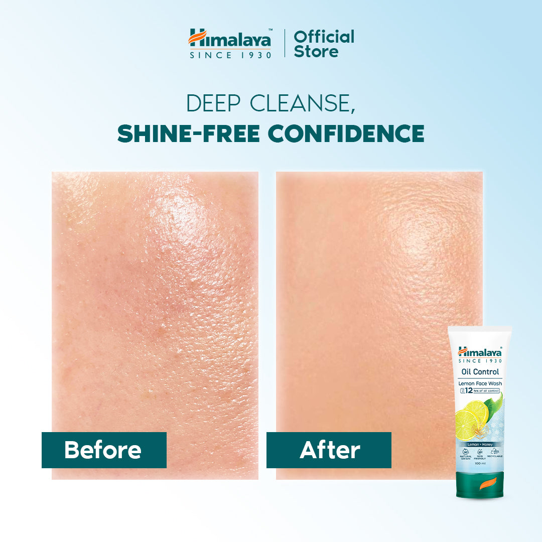 Himalaya Oil Control Lemon Face Wash