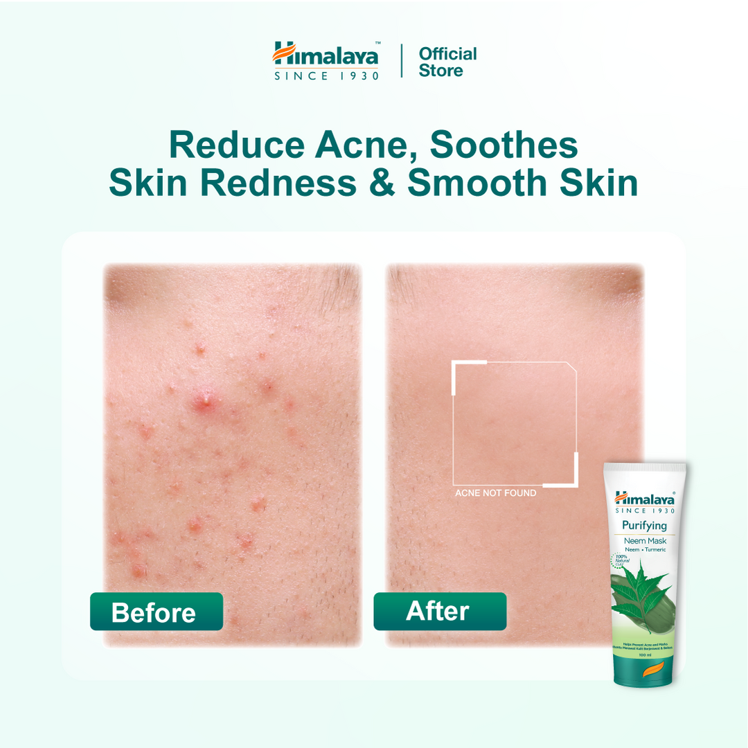 Himalaya Purifying Neem Face Mask