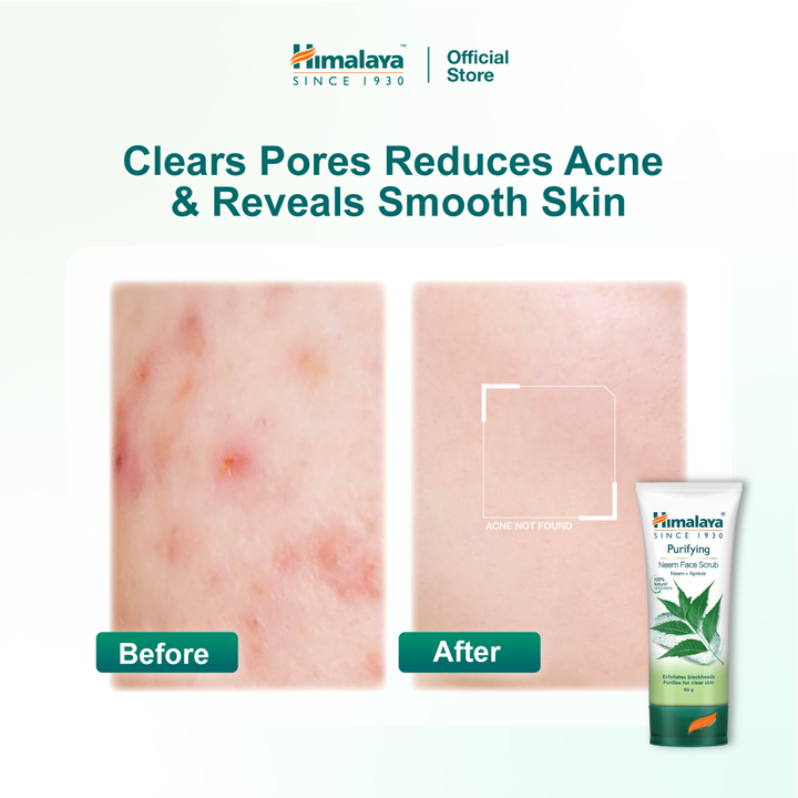 Himalaya Purifying Neem Scrub