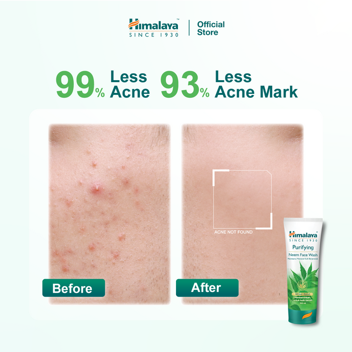 Himalaya Purifying Neem Face Wash
