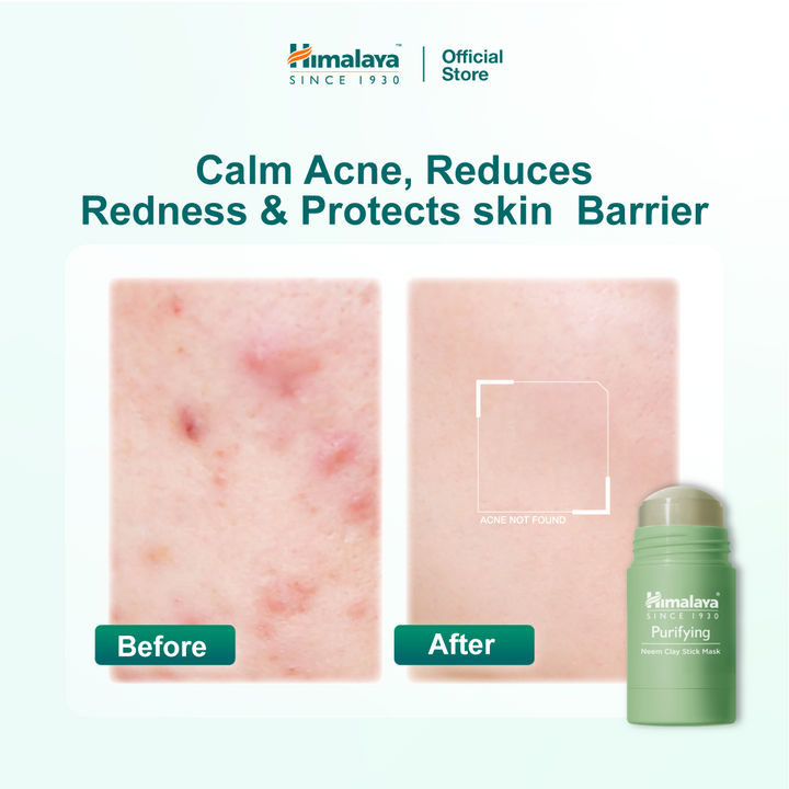 Himalaya Purifying Neem Clay Stick Mask
