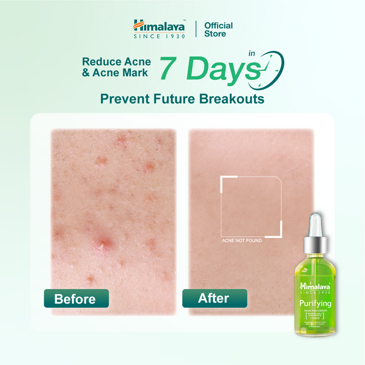 Himalaya Purifying Neem Face Serum